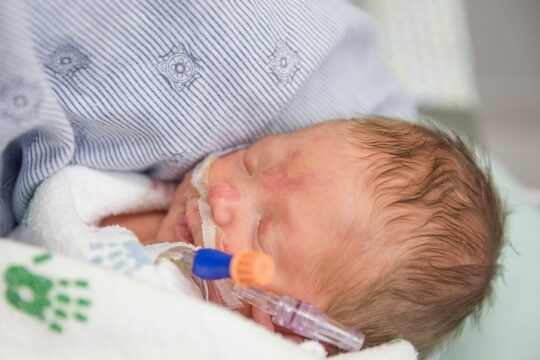 Retinopathy of Prematurity (ROP) Retinopathy of Prematurity (ROP)