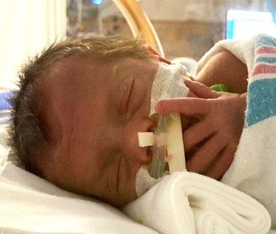 Retinopathy of Prematurity (ROP) and your child’s lifelong vision health